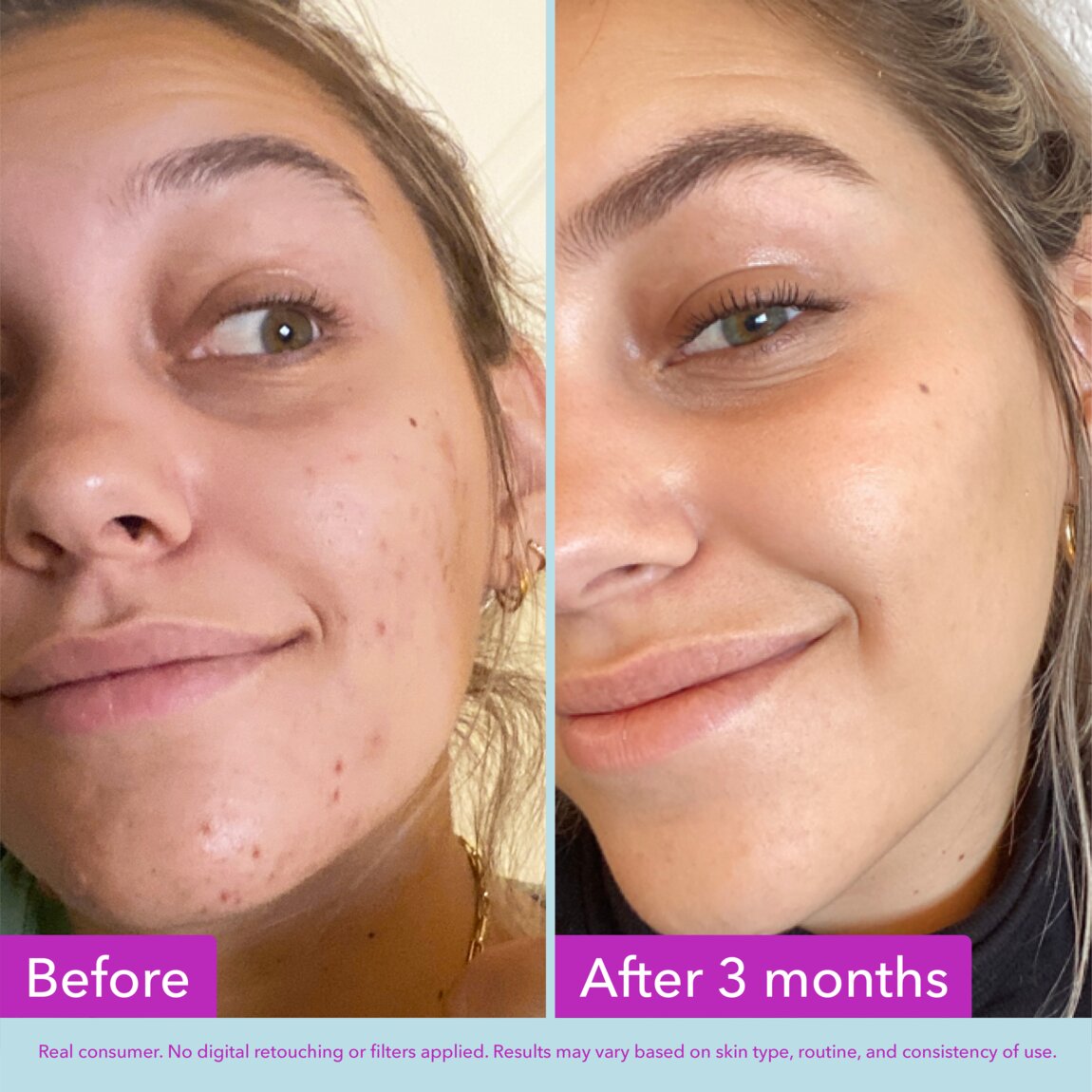 niacinamide-brightening-toner-k0 zb_p.jpg