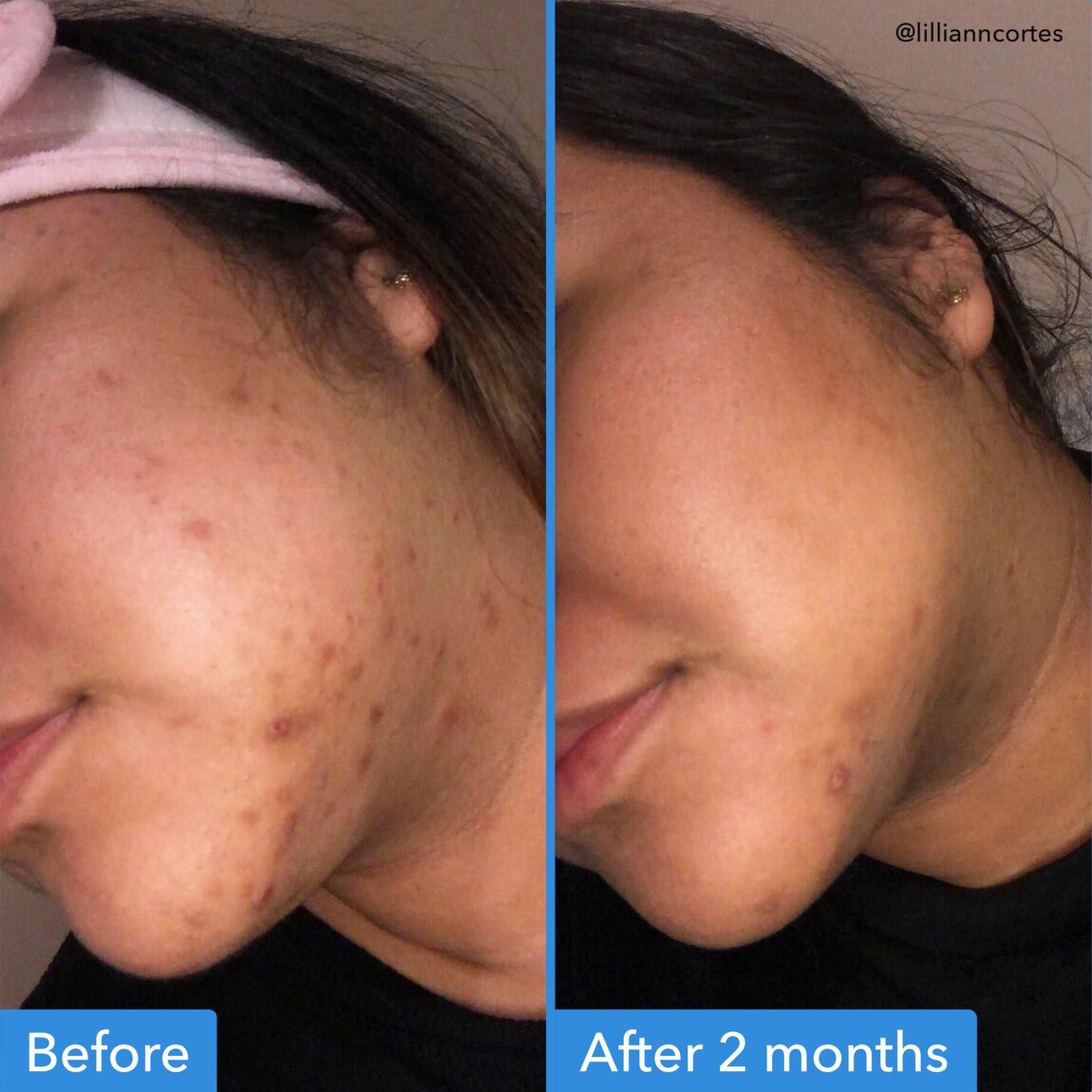 discoloration-correcting-serum-m3 zb_p.jpg