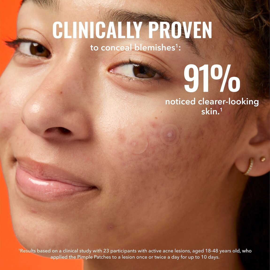 pimple-patches-k3 zb_p.jpg