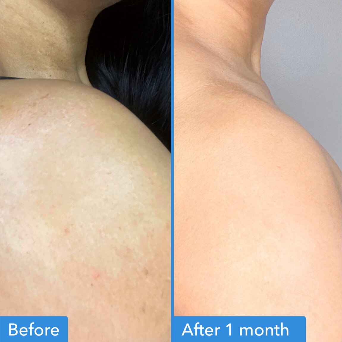 discoloration-correcting-body-treatment-b9 zb_p.jpg